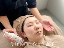 ロイ(Loy)/最新型ビタミンC誘導体【APPS】