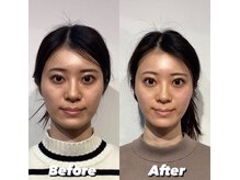 コルミチョン サロン(骨美整 salon)/Before・After(左右非対称施術)