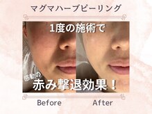 ジュエル(Jewel)