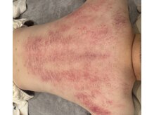 ホスピー(Hosppy)の雰囲気(カッサで全身の血流、リンパ、経絡を流してデトックス!)