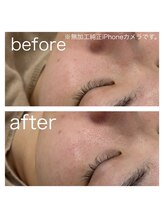 ラクシー 御徒町(luxssy)/目元のトーンアップ