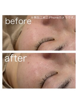 ラクシー 御徒町(luxssy)/目元のトーンアップ