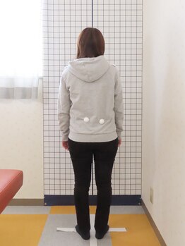 ひよこ整骨院/姿勢分析