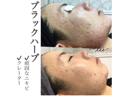アンド リー(and lee)の写真