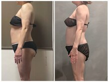 ツーアップ(2up)/お腹太ももの張り,肩こり