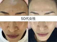 サクラ 伊勢原店(SAKURA)/SNSの取材を受けました