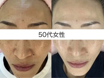 サクラ 伊勢原店(SAKURA)/SNSの取材を受けました