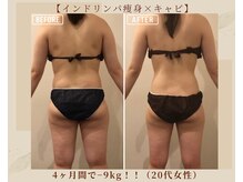 オキシー グレイス 黒崎店(OXY Grace)/インドリンパ痩身×キャビ