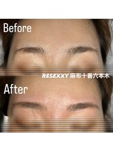 リゼクシー INTERNATIONAL麻布十番 六本木(RESEXXY)/