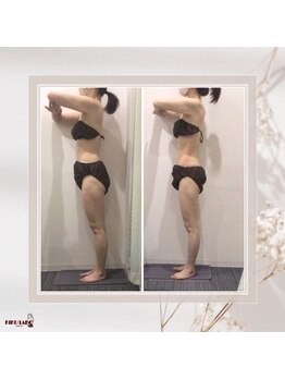 効くラボ 梅田店/１回でこの変化