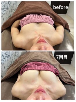 ロココ 豊田店(Rococo)/ビフォーアフター