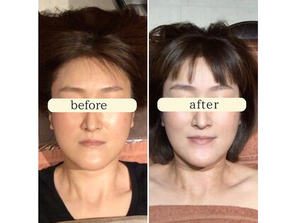 ユジュ(yju)の写真