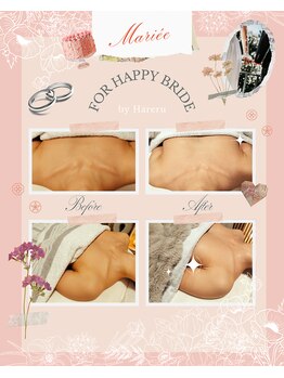ハレル(Hareru)/Before…After(12)　ブライダル
