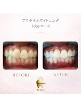 ドクターモック(Dr.MOC)/