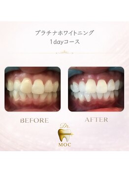 ドクターモック(Dr.MOC)/