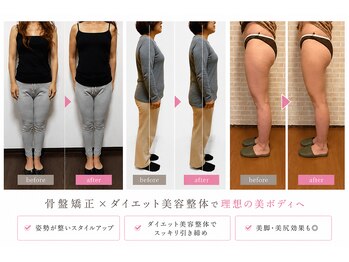 練馬アカデミア美容整体院の写真/痩せない原因は骨盤・姿勢の崩れです。美容骨盤矯正・ダイエット整体で、自信もってよりスタイリッシュに♪
