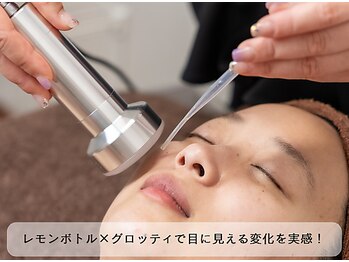クオーレ(cuore)の写真/【美容大国韓国で大人気♪】小顔脂肪分解液レモンボトル★最新の脂肪分解施術を体験《ダウンタイム無し》
