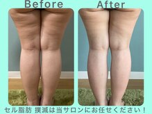 ビーナイス ビューティー(Be Nice Beauty)/★ 下半身サイズダウン ★秘訣は