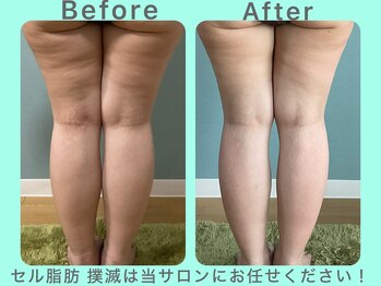 ビーナイス ビューティー(Be Nice Beauty)/★ 下半身サイズダウン ★秘訣は