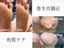 イーデザイン ネイル(E.design.Nail)
