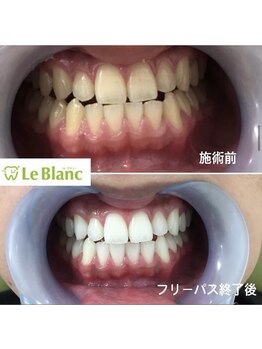 ルブラン 奈良店(Le Blanc)/同時施術可能です!