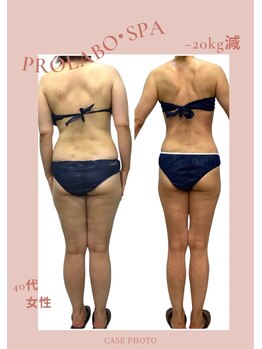 プロラボスパ 渋谷店/40代女性