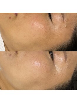 フォーユー(4U)/一度で透明感アップ