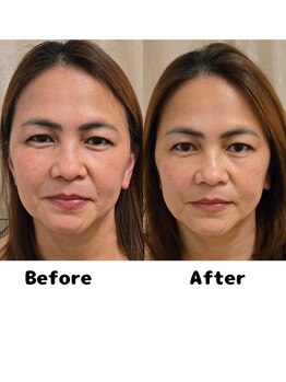 クリニカルスイート エーアール(Clinical sweet.ar)/小顔になって目がぱっちり