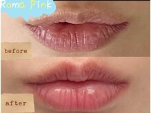 ビューティーサロン ベリーユー(VERY YOU)の雰囲気（ナチュラルなピンク色に♪痛み無し新しい美容技術）