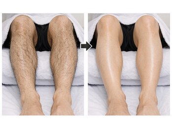 エスプラス エヌプラス(S+/N+)/どっちがモテる？