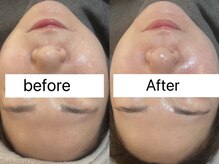 ビーマジック(Be Magic)/