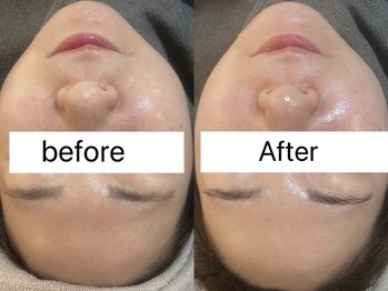 ビーマジック(Be Magic)/