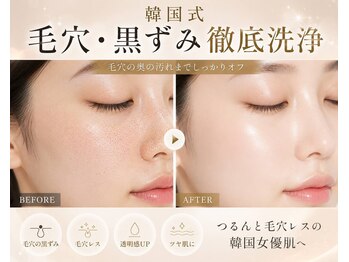 ファミリータイズカンパニーガデス(Family Ties Co. Goddess)の写真/韓国式毛穴洗浄で黒ずみ・角栓すっきり!つるんと陶器肌へ