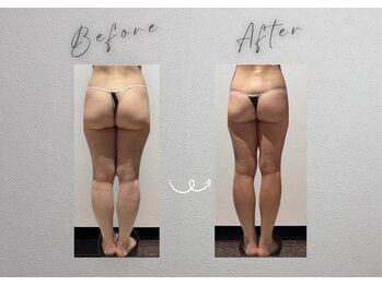 グラン 千葉(GRAND)の写真/何をしても痩せられない!20年暦の凄腕エステティシャンによるハンドとマシーンの融合施術