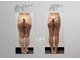 グラン 千葉(GRAND)の写真/何をしても痩せられない!20年暦の凄腕エステティシャンによるハンドとマシーンの融合施術