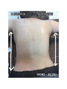 ノリスズ(NORI SUZU)/筋肉の縮み/骨盤の高さ/ウエスト