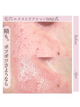 サロン サルタス(salon Saltus)/顔全部!