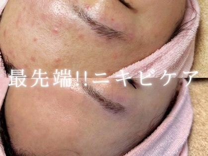 レッド(RED)の写真