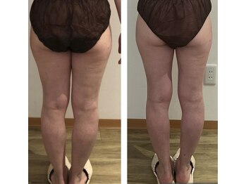 サロン ド モナ(salon de mona)/【太ももに隙間を！！】