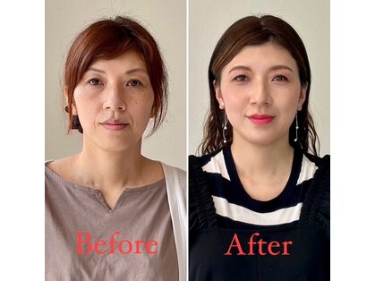 エイジレスビューティーアカデミー(Ageless Beauty Academy)の写真