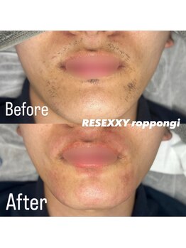 リゼクシー INTERNATIONAL麻布十番 六本木(RESEXXY)/