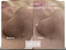 ルフ エステティック ビューティー(ruf esthetic beauty)