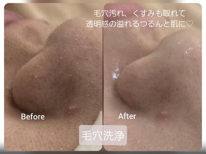 ルフ エステティック ビューティー(ruf esthetic beauty)の写真