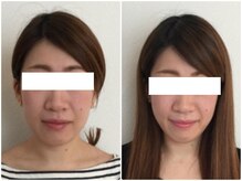 美容整体ウェリナ あま甚目寺院/小顔矯正/骨盤矯正/美脚サロン