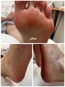 ≪足の角質ケアにお悩みの方へ！≫フットケア（90分）￥6,500