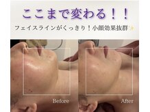 ユフラ(Juhla)の雰囲気（1度でここまでたるみが変わる小顔リフト/ボディメニューも豊富）