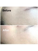 スウィートラッシュ 朝霞台店(Sweet Lash)/フェイスワックス