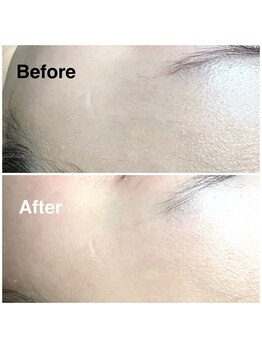 スウィートラッシュ 朝霞台店(Sweet Lash)/フェイスワックス