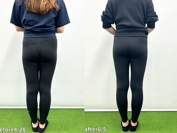 モア 札幌大通店(MORE)/長年の前もものハリが抜けた