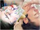 サプル(supple)の写真/<ハリ&弾力が桁違い★衰え肌が覚醒◎>ゆるんだ肌もピタッと引き締まる♪【韓国式リジュラン×美容鍼】
